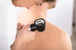Dlaczego warto zdecydować się na dermatoskopy firmy Heine?